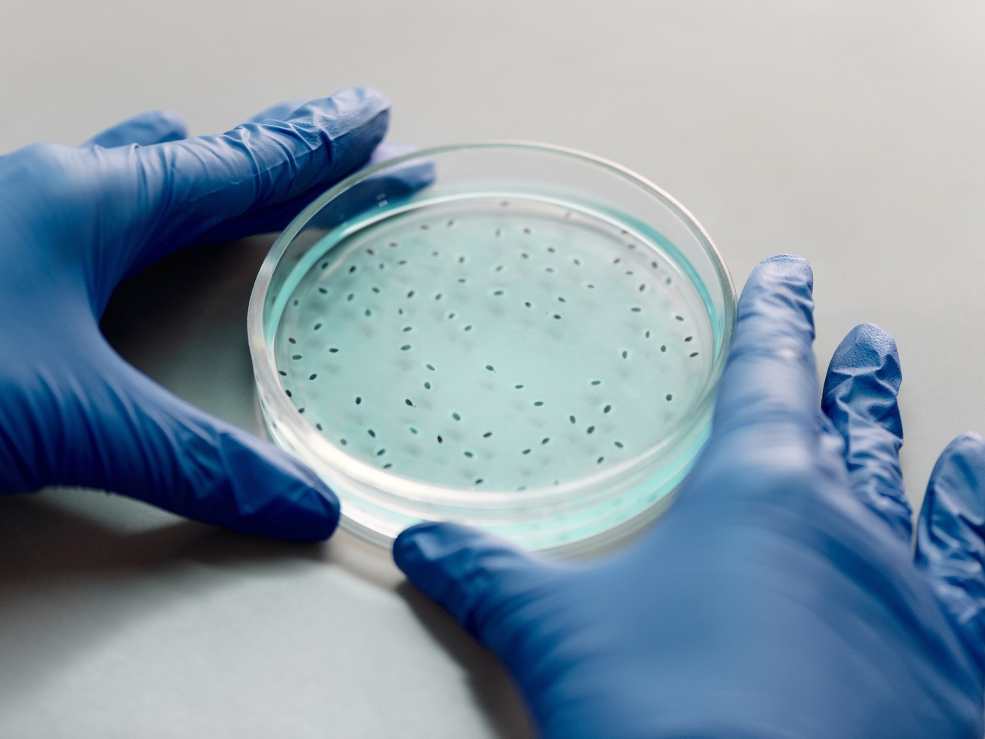 oplossingen-inspecteren-en-keuren-legionella-petrischaal-met-handen-2000x1333.jpg